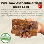 Traditional African Black Soap — Ghanaian Skincare